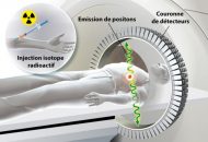 L’hôpital de la Timone pour adultes, réalise des TEP Scan